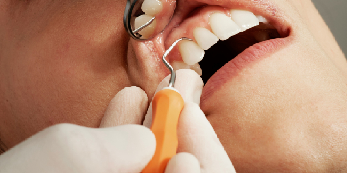 Dental Care Dental Care