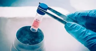 Stem Cell Preservation
