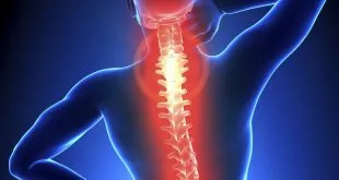 neck and back pain