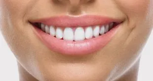 Full Mouth Reconstruction