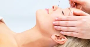 Acupuncturist