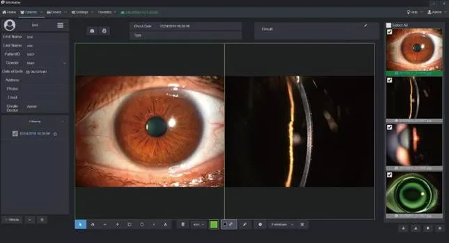slit lamp microscope with an AI system