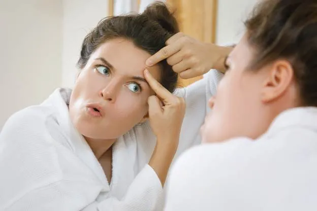 Adult Acne