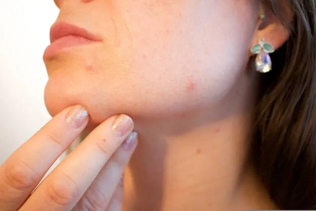 Types of Skin Conditions