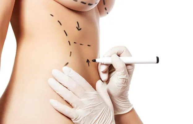 Body Contouring Surgery