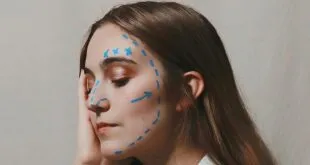Facelift