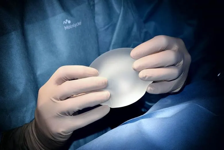 Breast Lift