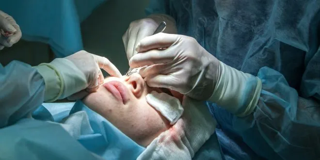 plastic surgeon